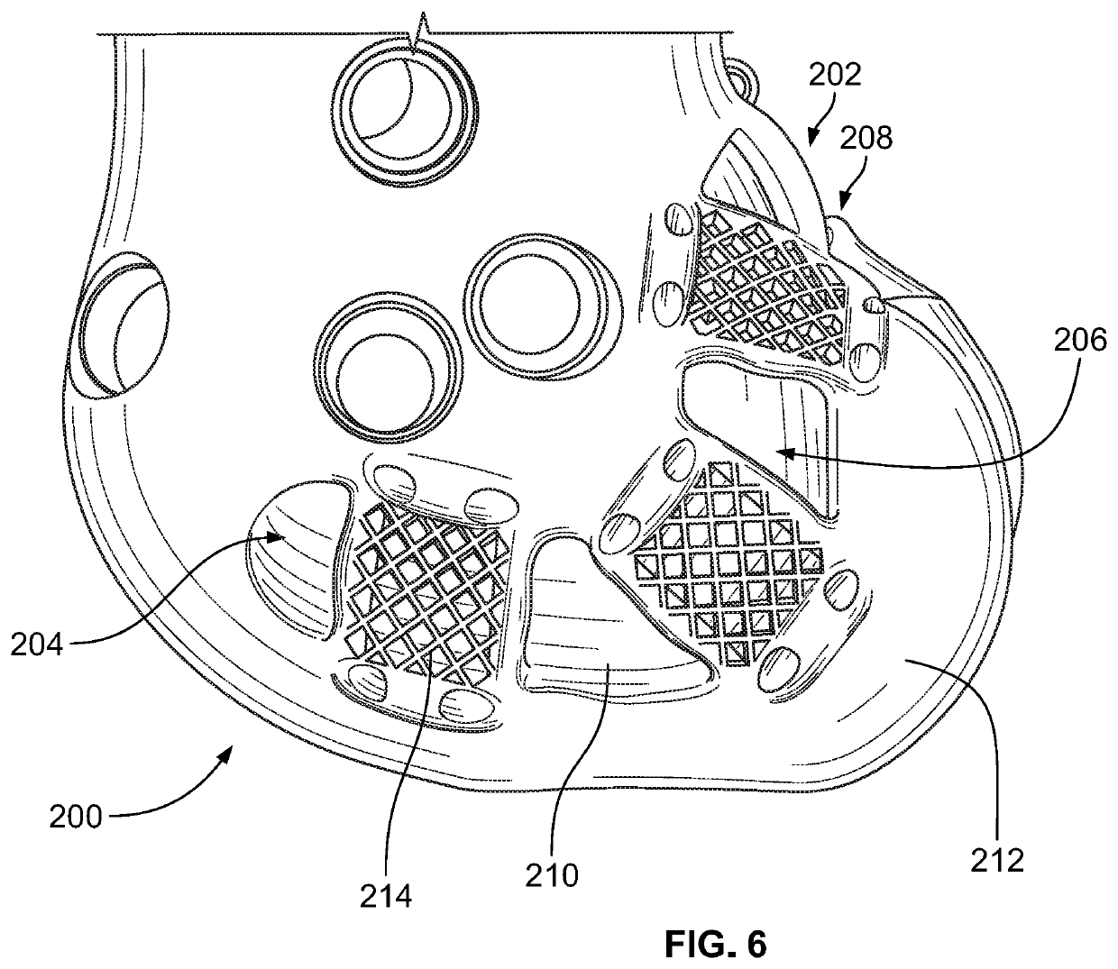 Systems and methods for attaching soft tissue to an implant