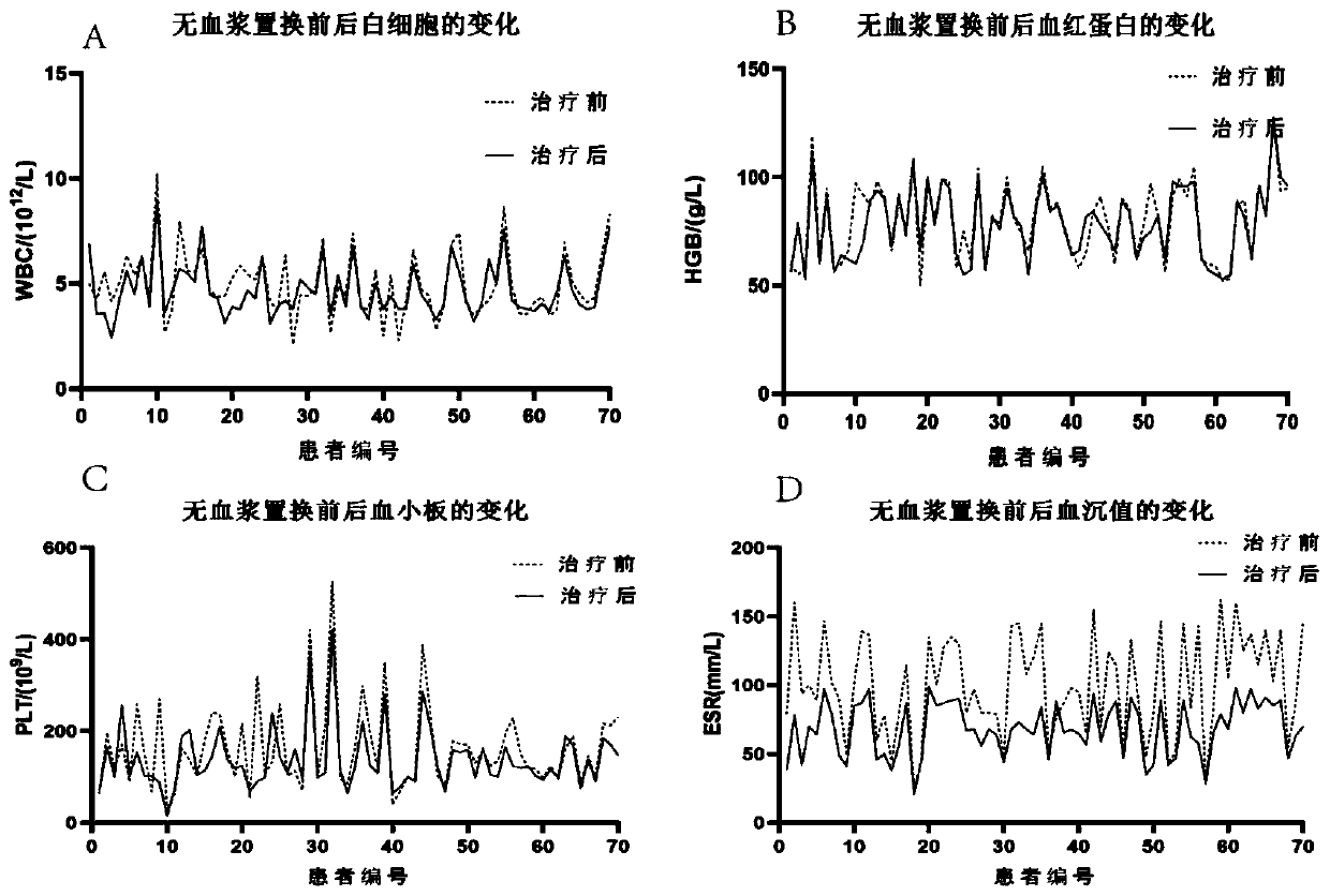 Application of plasma-free replacement liquid composition in preparation of medicine for removing M protein of multiple myeloma