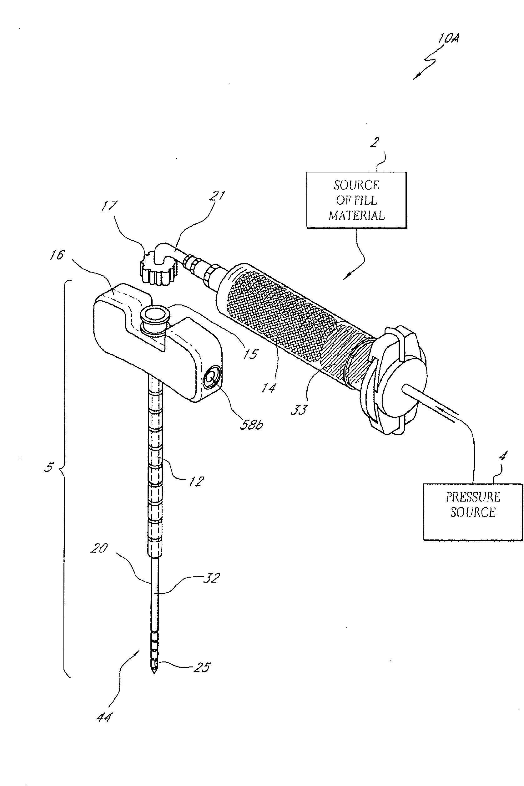 Bone treatment systems and methods