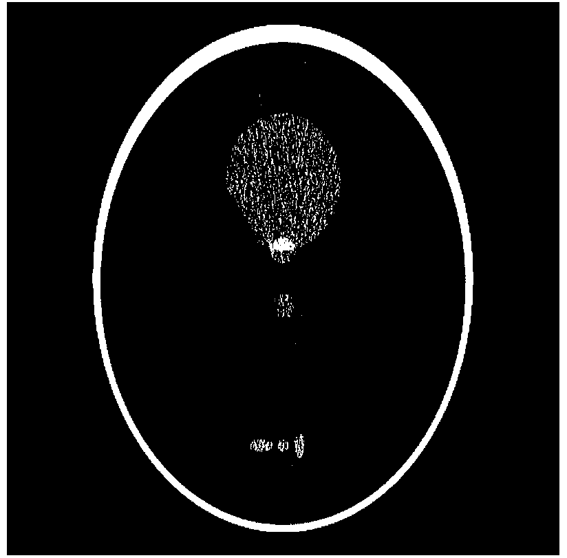 Low-dose X-ray CT projection data restoring method