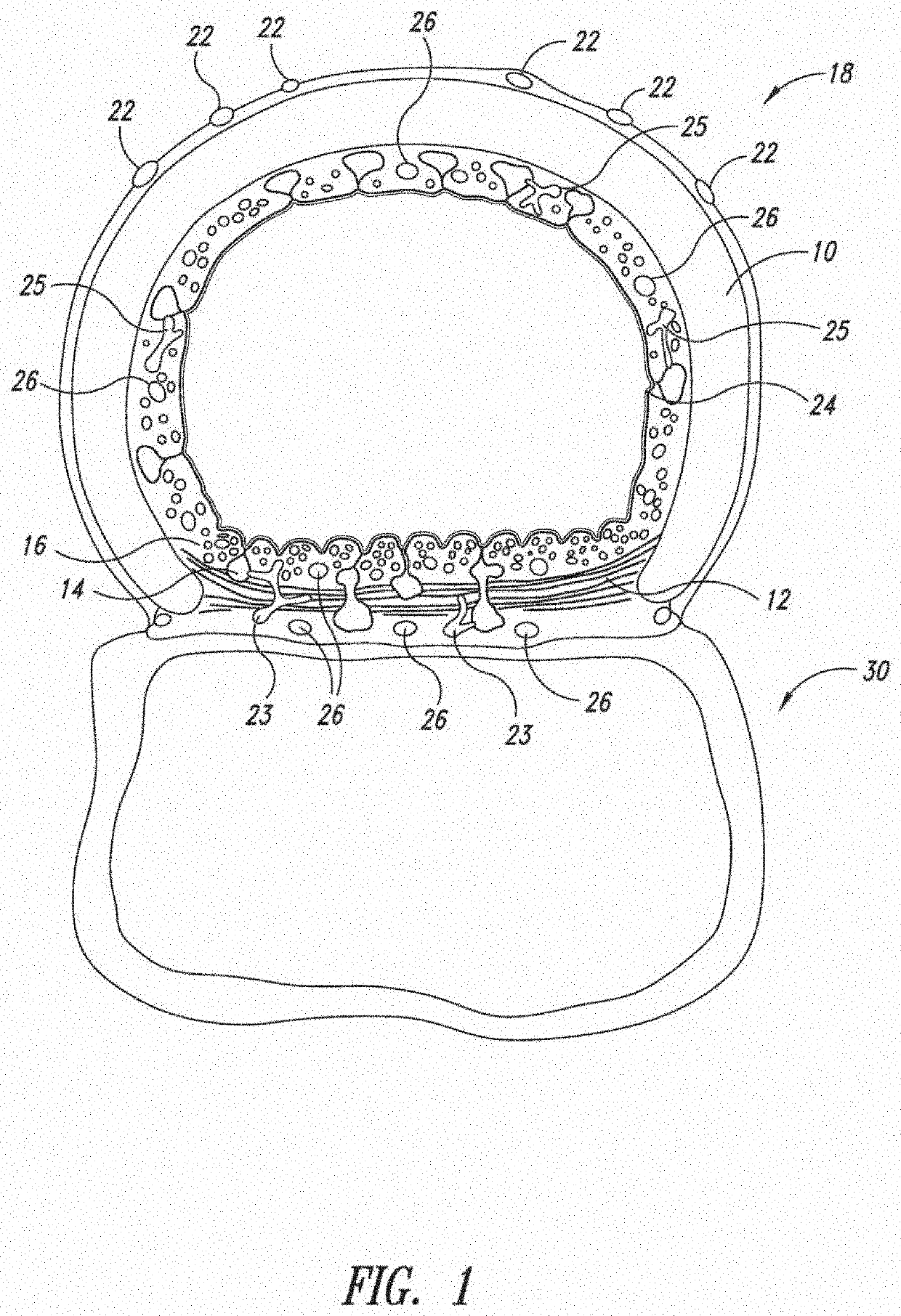 System and method for pulmonary treatment