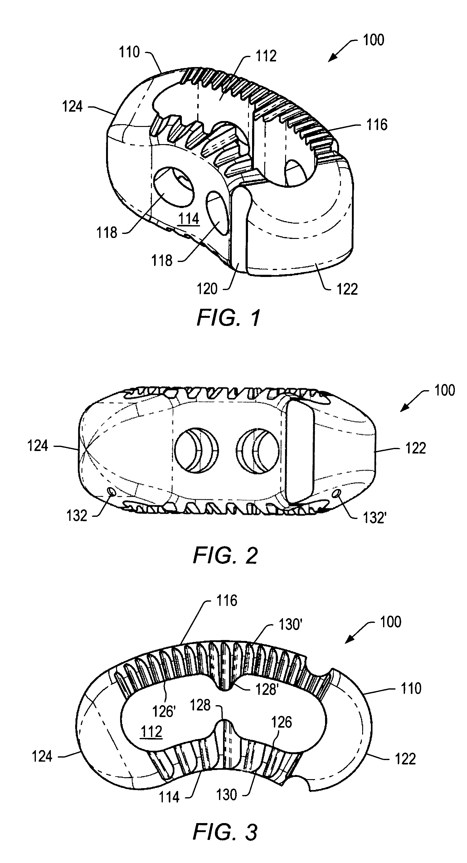 Spinal implant