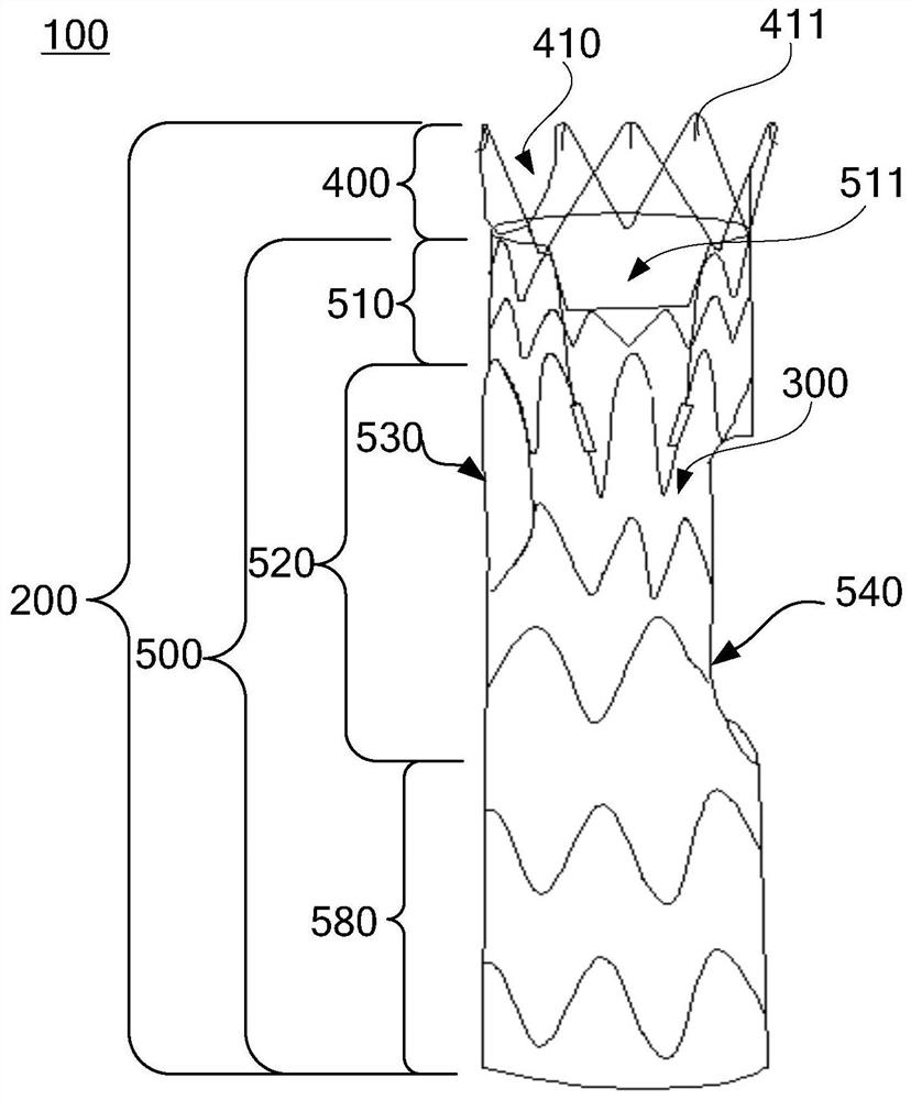 A branched stent-graft and a branched stent-graft system