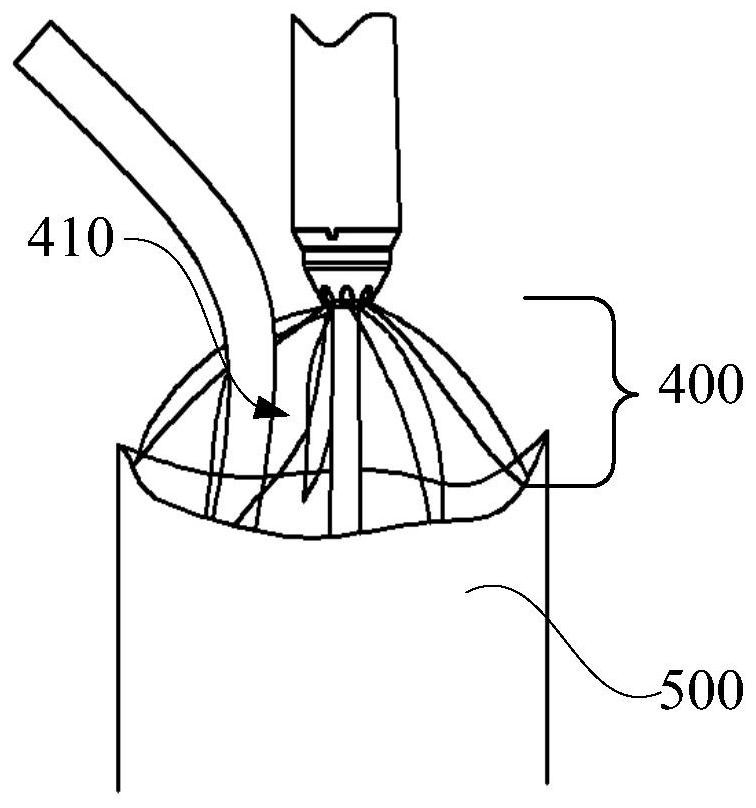 A branched stent-graft and a branched stent-graft system