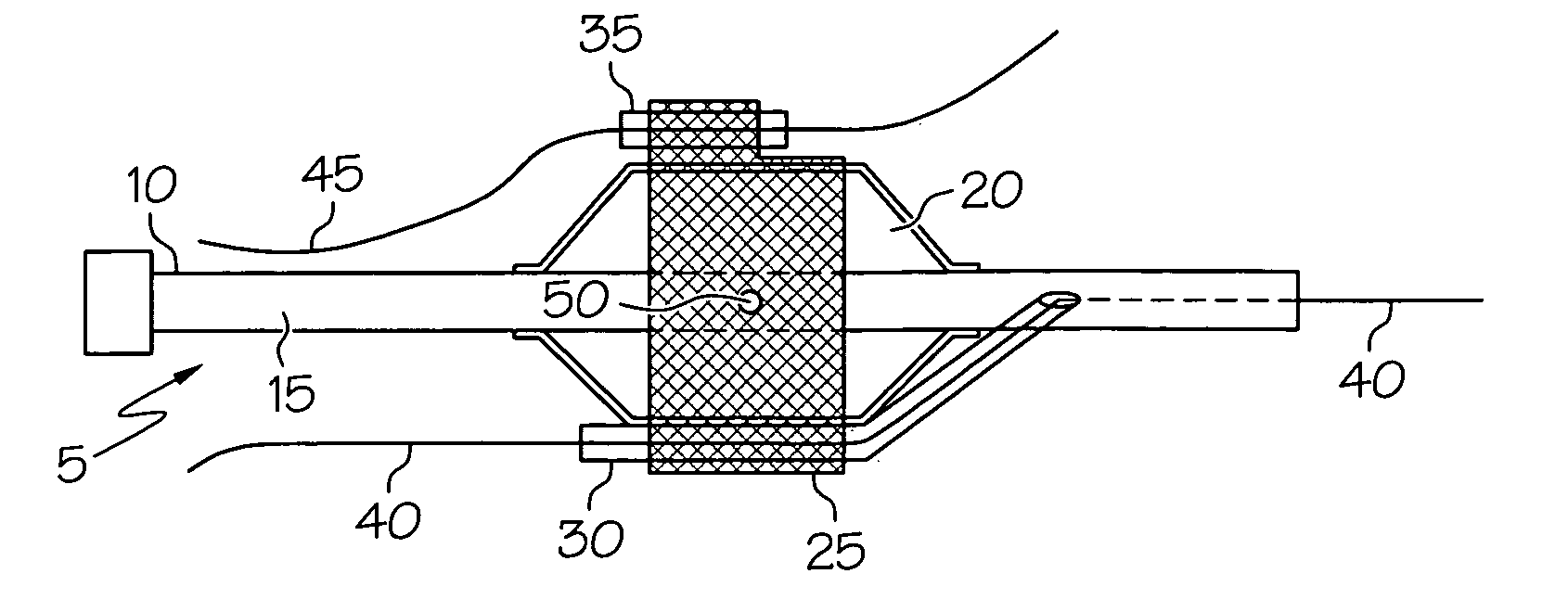 Bifurcation stent delivery system