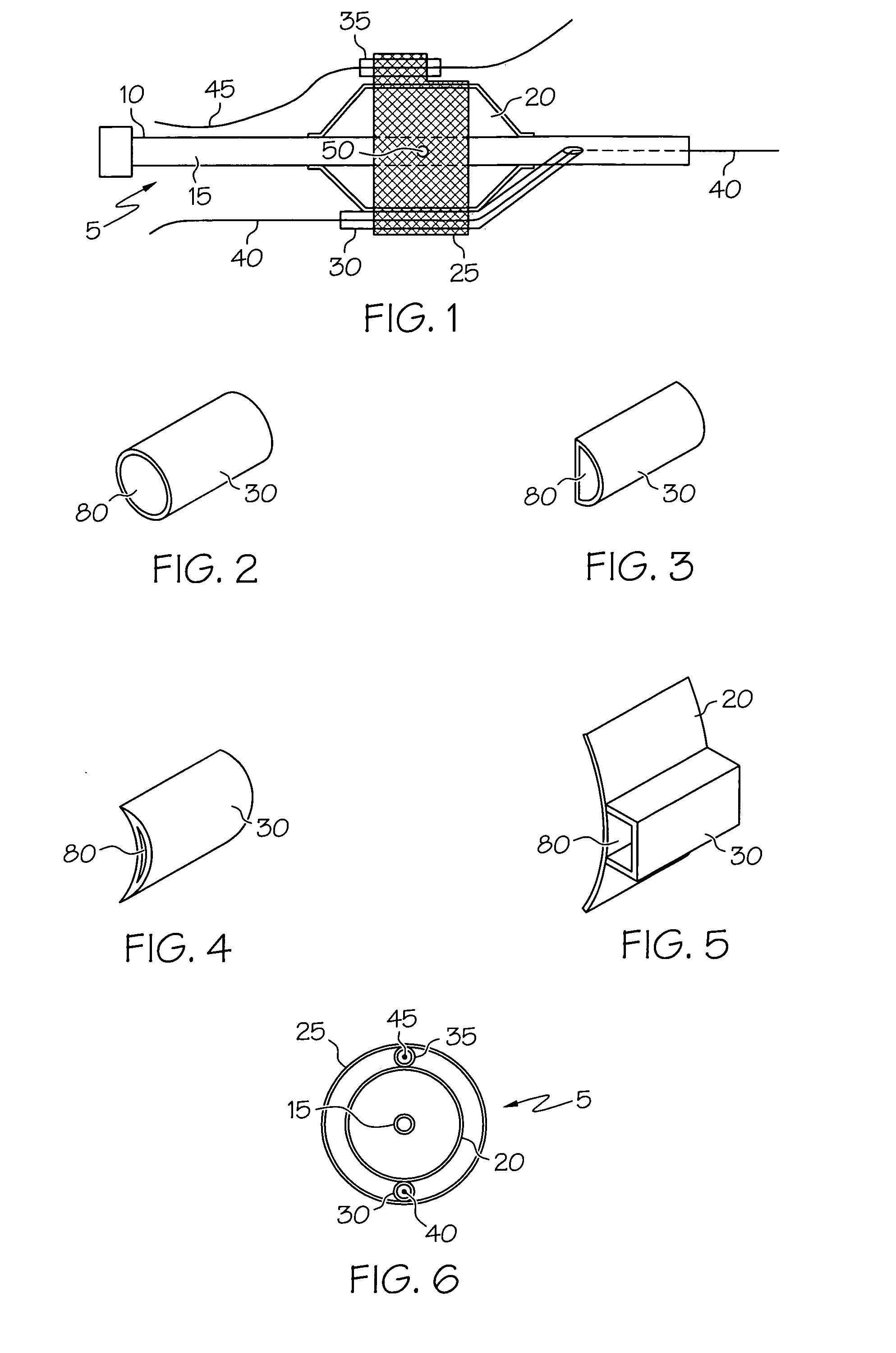 Bifurcation stent delivery system