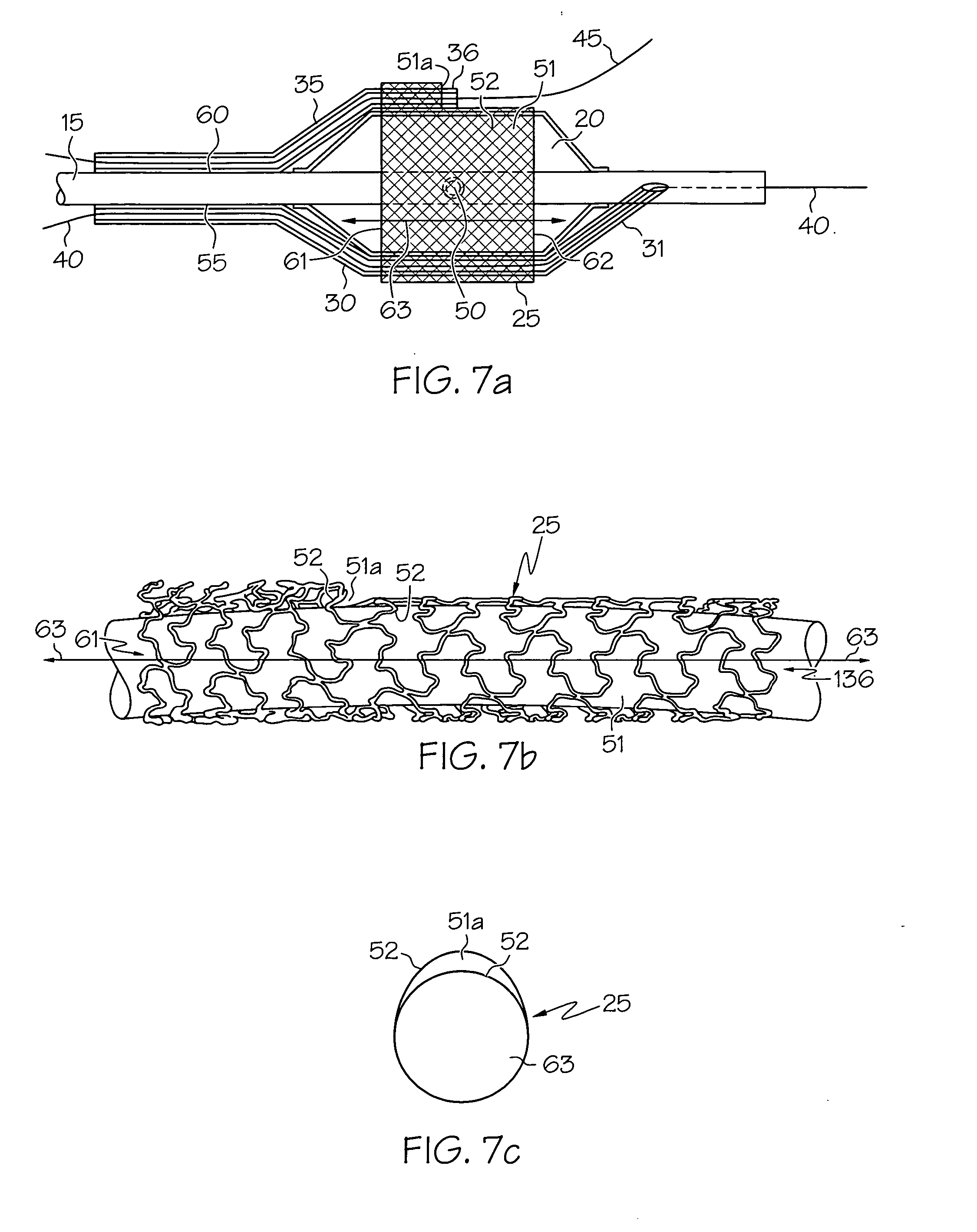 Bifurcation stent delivery system