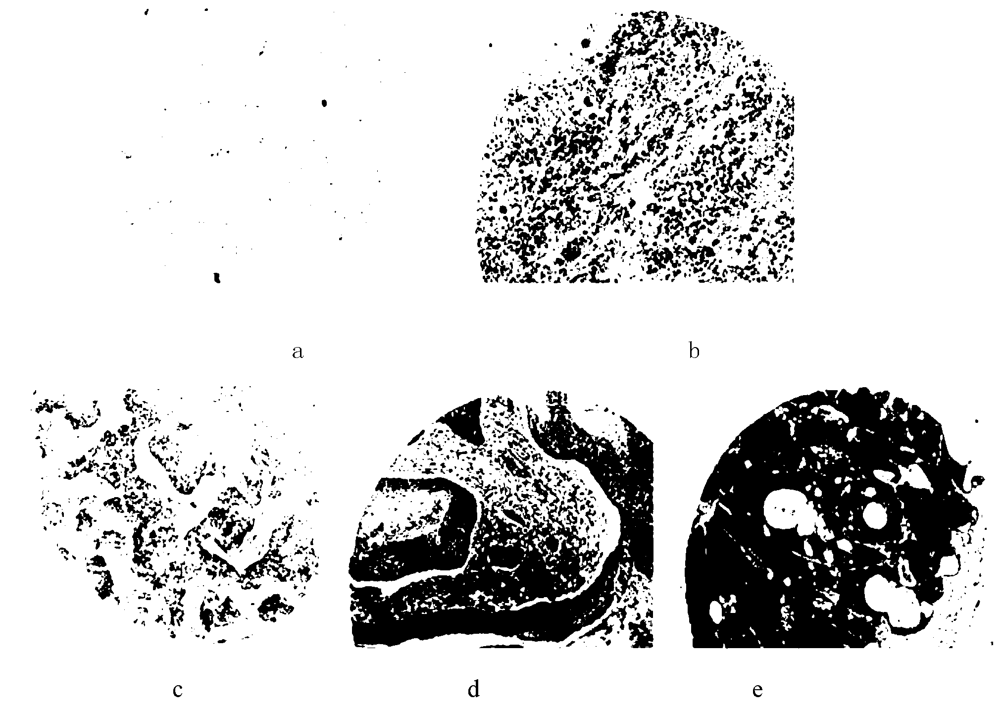 Tumor necrosis factor-alpha induced protein 8 L3 (TIPE3) immunohistochemistry detection kit for diagnosing lung cancer