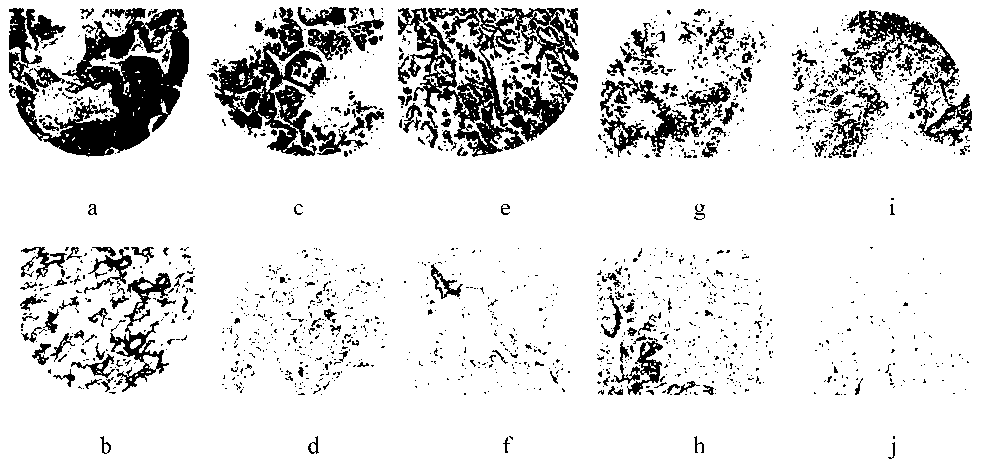 Tumor necrosis factor-alpha induced protein 8 L3 (TIPE3) immunohistochemistry detection kit for diagnosing lung cancer