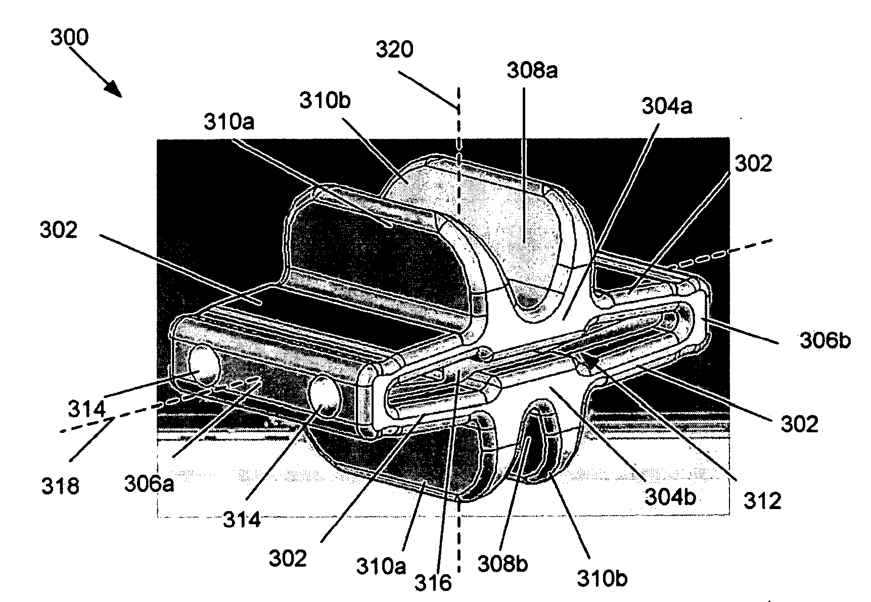 Expandable support device and method of use