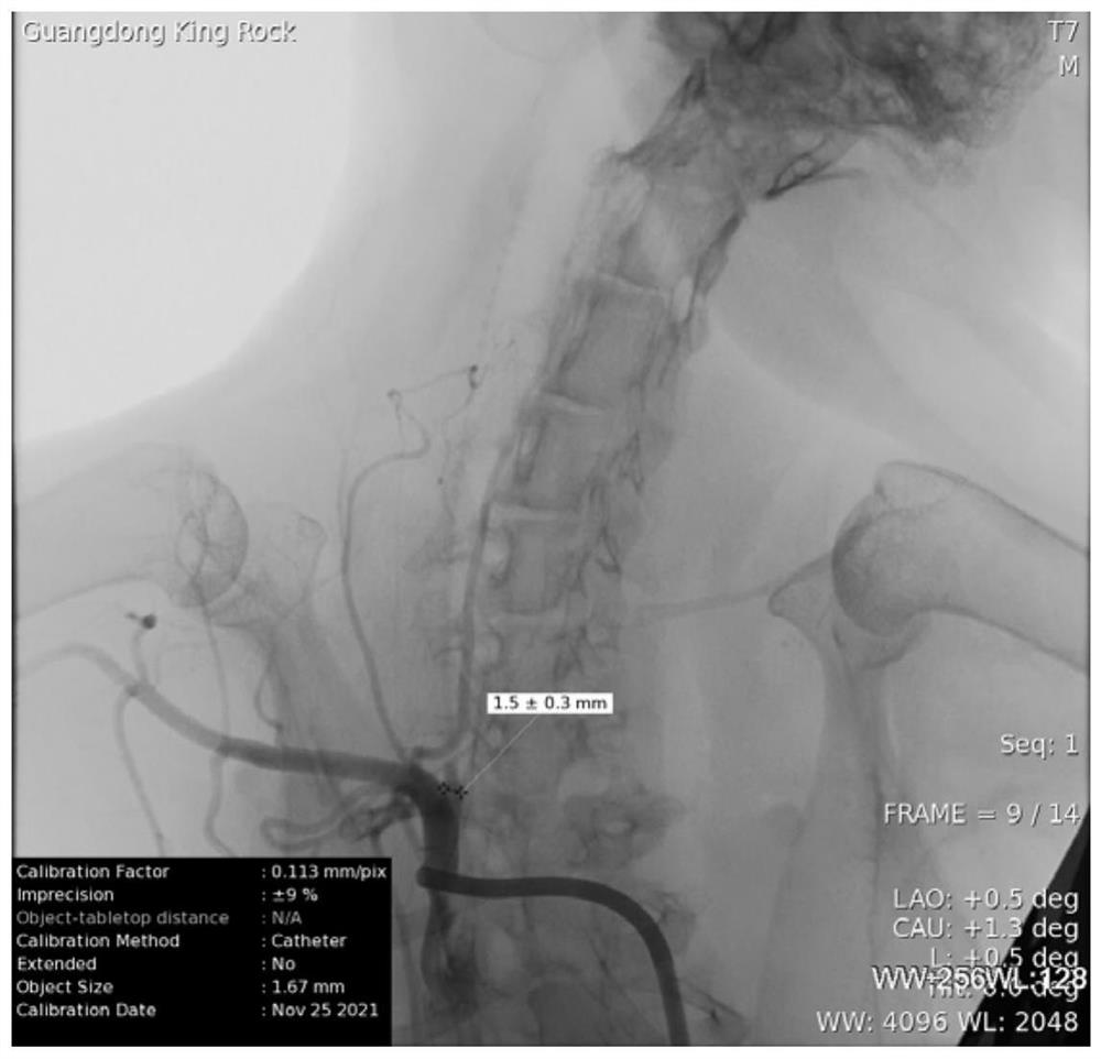 Method for constructing rabbit aneurysm model