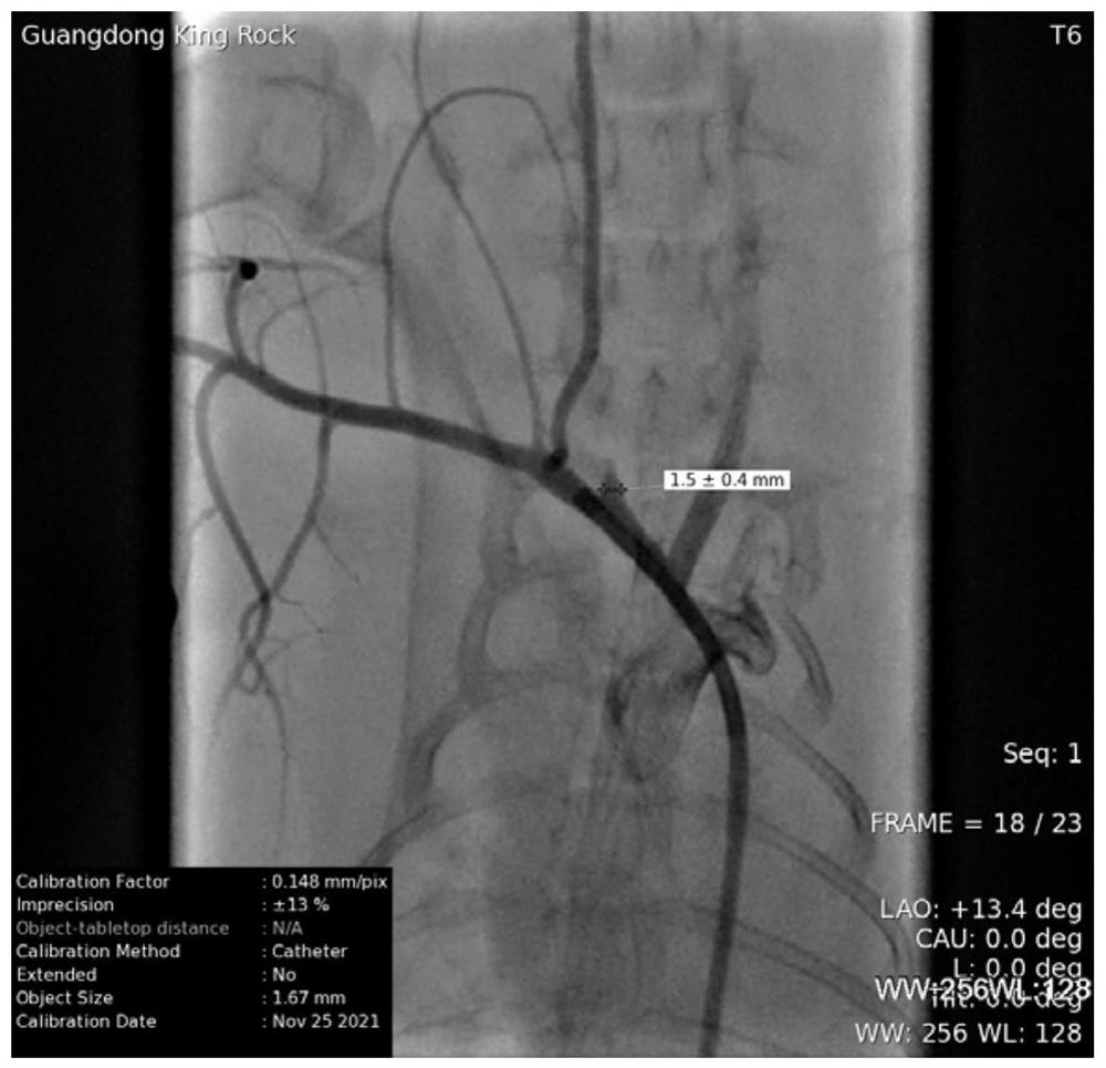 Method for constructing rabbit aneurysm model