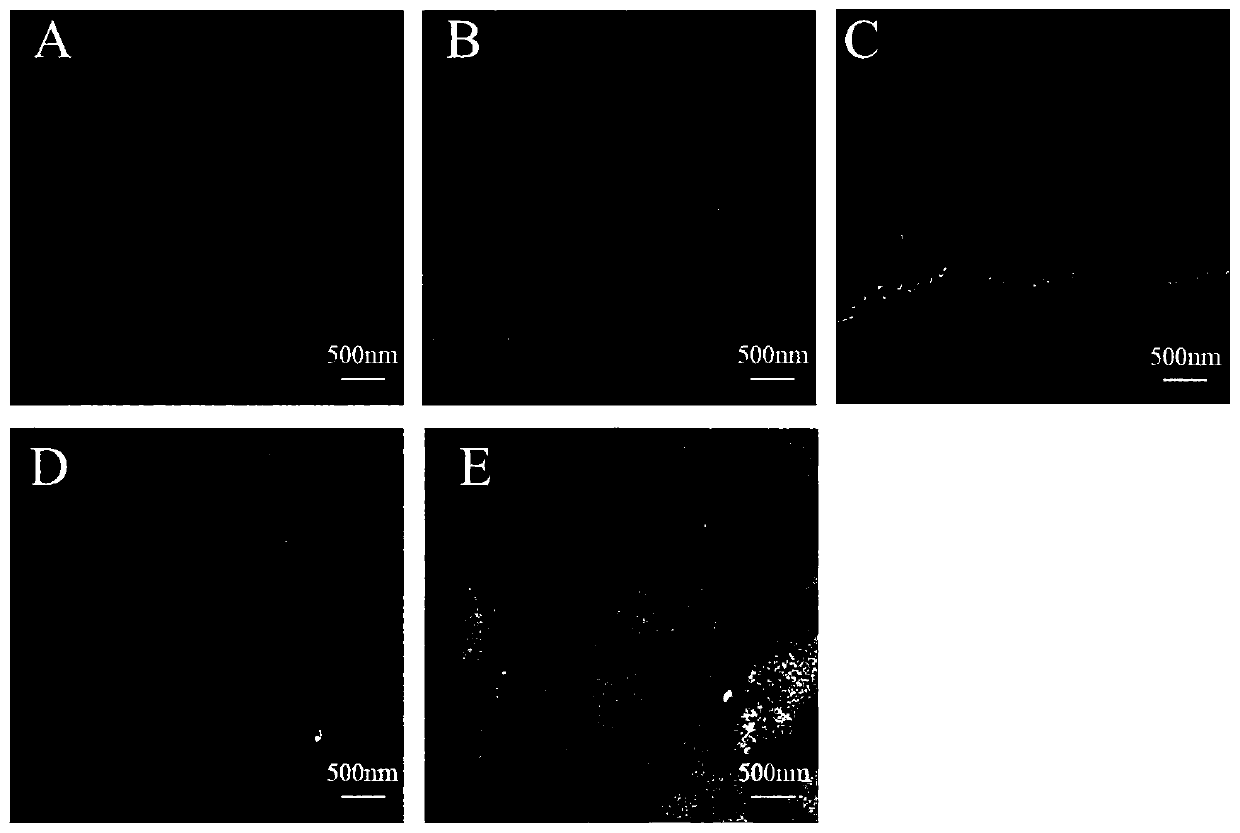 Application of chondroitin sulfate nano selenium in preparing medicine for treating nervous system diseases related to cognitive function decline