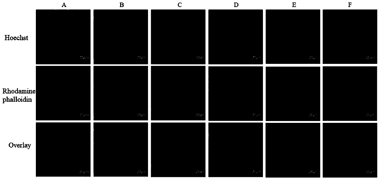 Application of chondroitin sulfate nano selenium in preparing medicine for treating nervous system diseases related to cognitive function decline