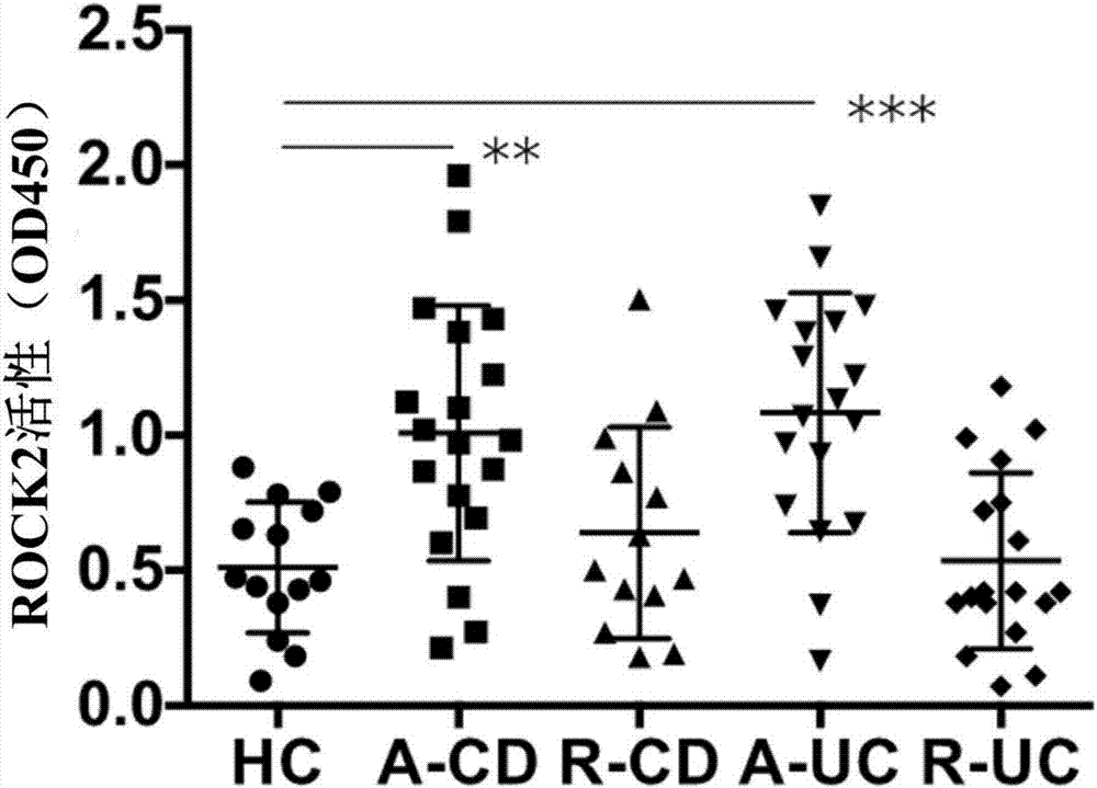 Applications of ROCK2 inhibitor in preparing medicines for treating inflammatory bowel diseases