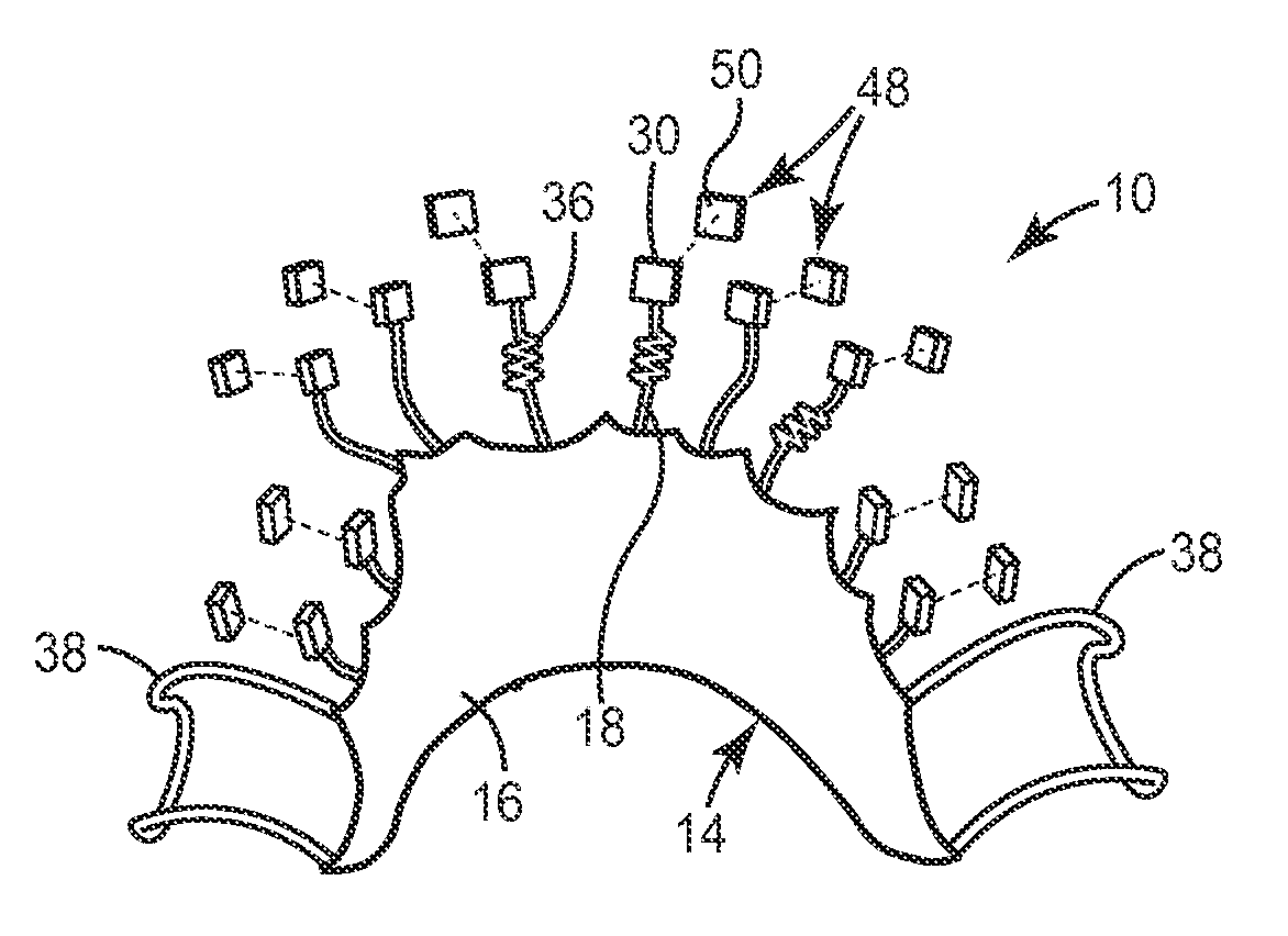 Lingual Orthodontic Appliance with Removable Section