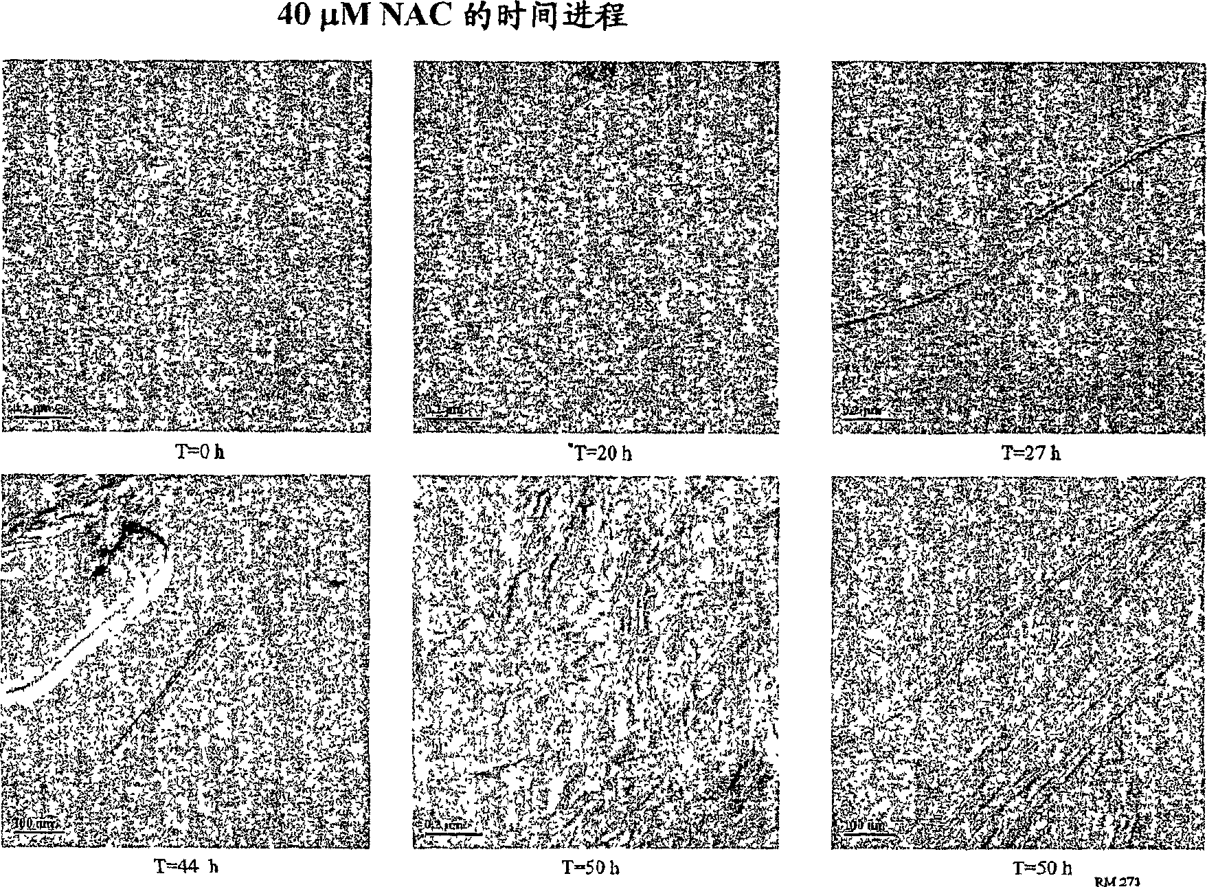 Methods for treating protein aggregation disorders