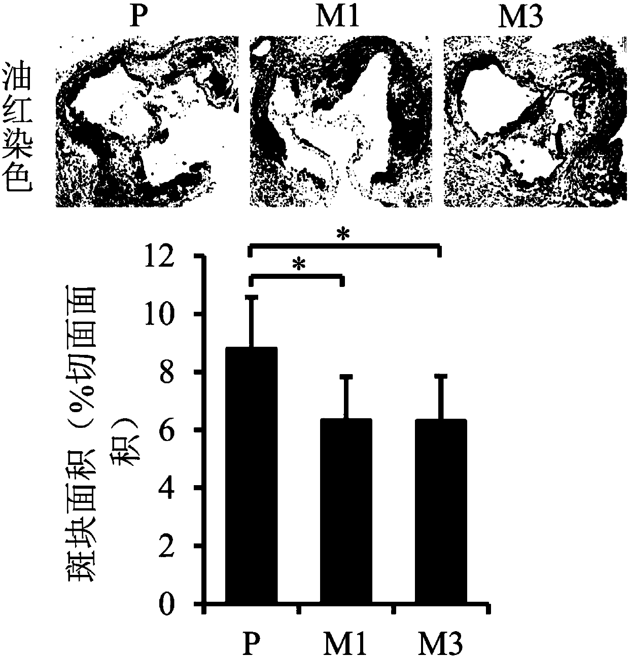 Applications of compound SS-31 in preparing drugs or preparations used for treating atherosclerosis and related diseases