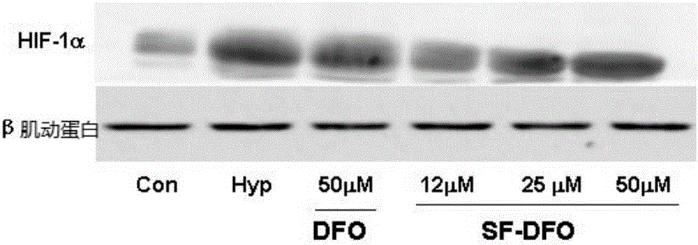 Deferoxamine derivative compound with bone affinity, preparation method and application thereof