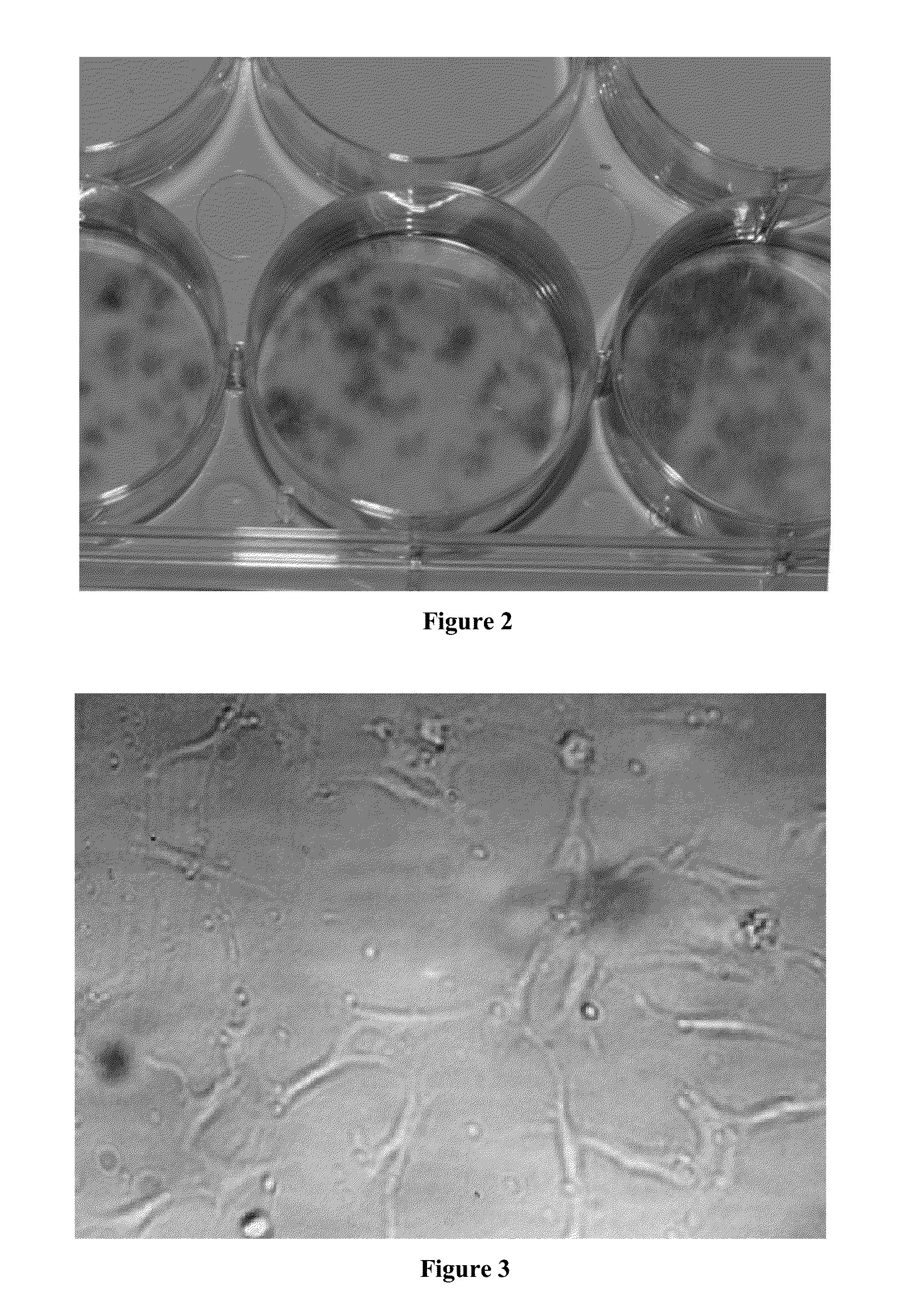 Compositions and methods for reducing frequency and/or severity of headache