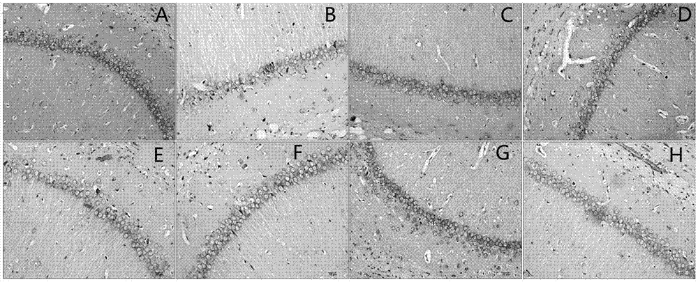 Composite capable of preventing and controlling hyperlipidemia and heart vessel, cerebral vessel or neuron damage caused by hyperlipidemia, and corresponding preparation and use methods