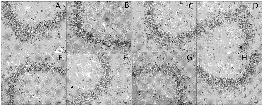 Composite capable of preventing and controlling hyperlipidemia and heart vessel, cerebral vessel or neuron damage caused by hyperlipidemia, and corresponding preparation and use methods