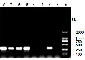 Primer for detecting orchid colletotrichum gloeosporioides molecules and quick detection method