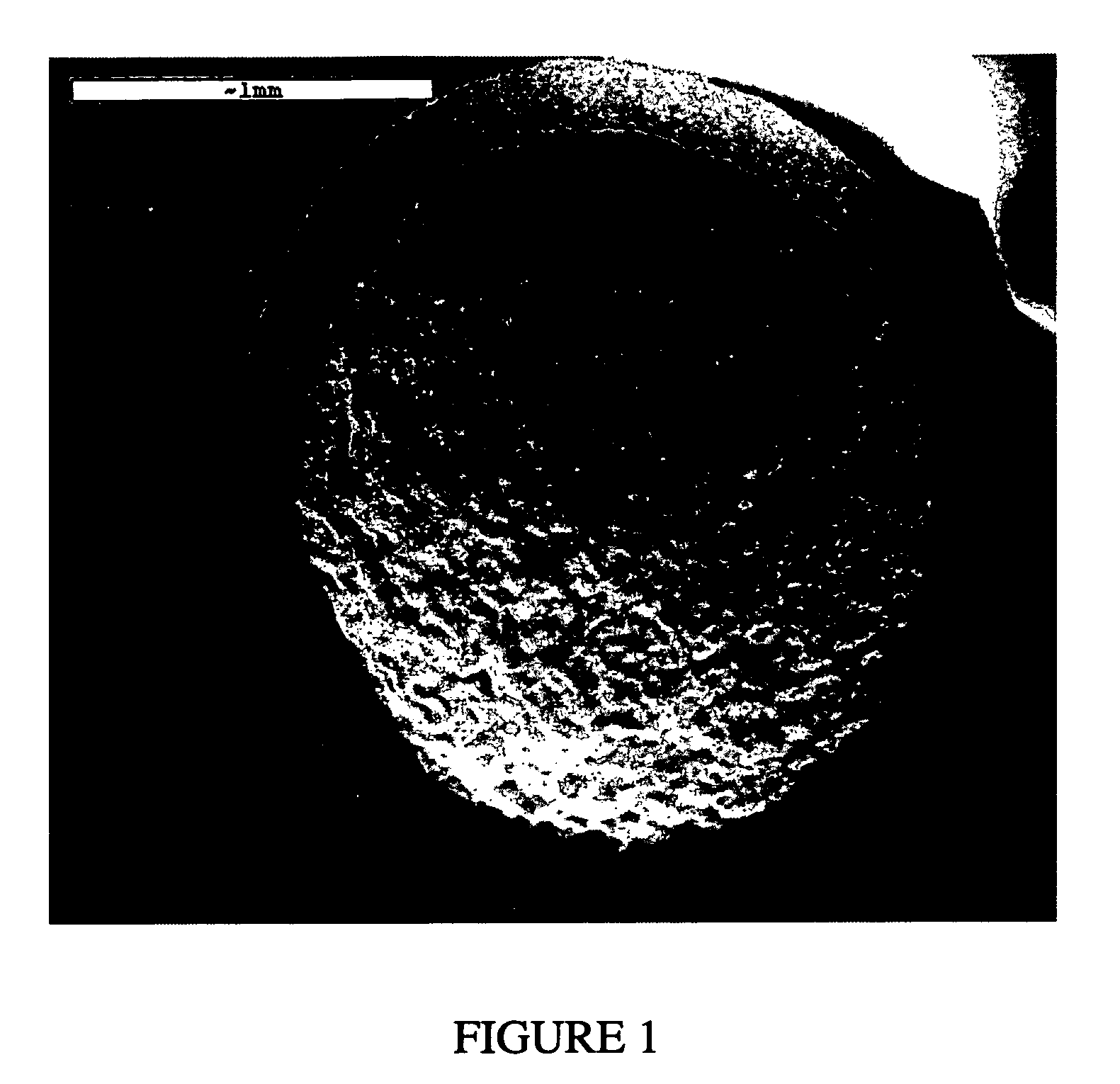 Composite metal foam and methods of preparation thereof