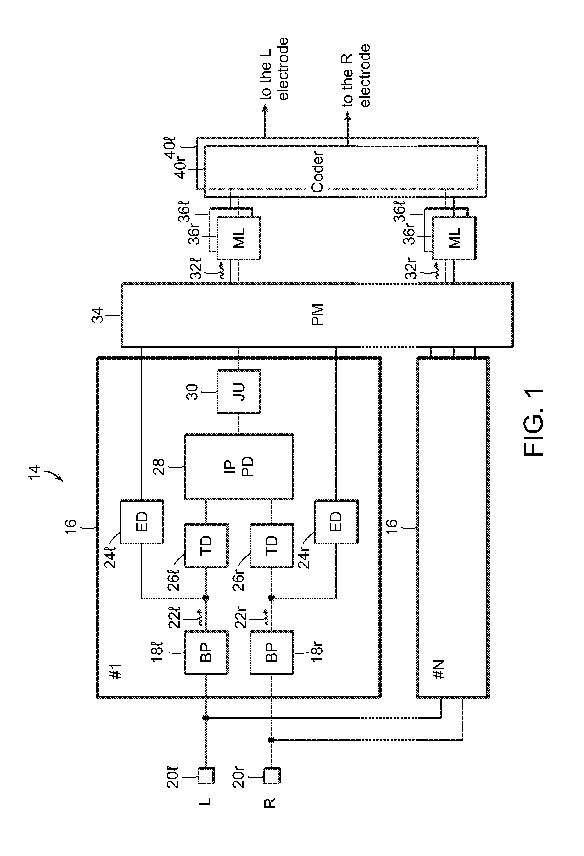 Binaural stimulation in neural auditory prostheses or hearing aids