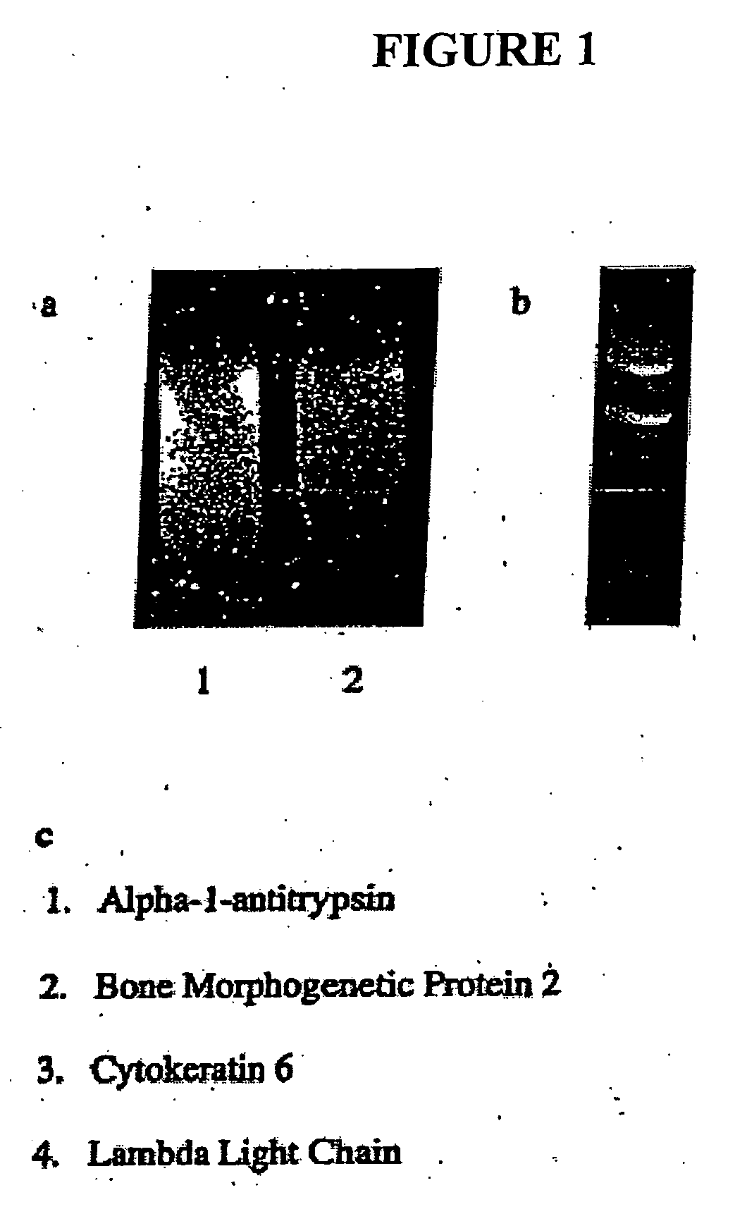 Bone morphogenetic protein-2 in the treatment and diagnosis of cancer