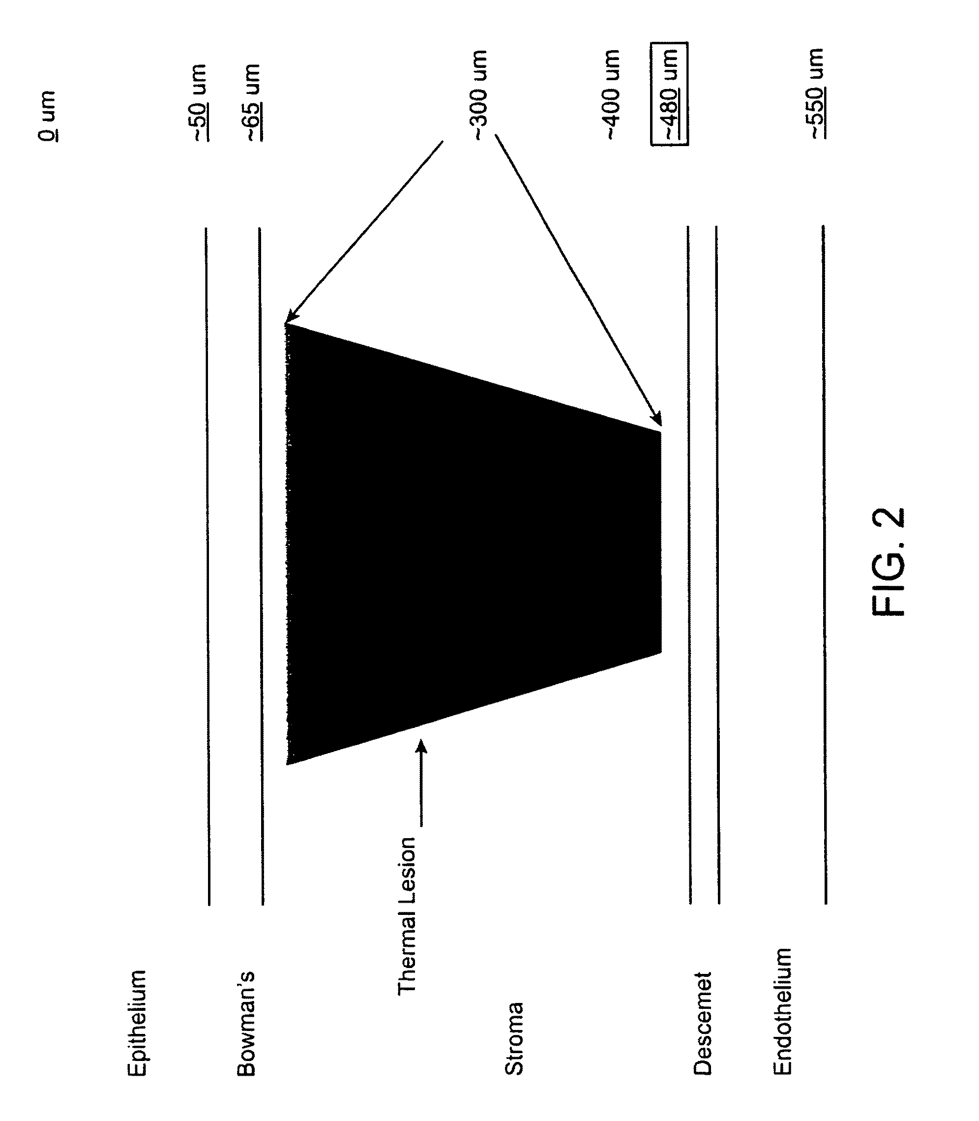 Method and apparatus for treatment of ocular tissue using combine modalities