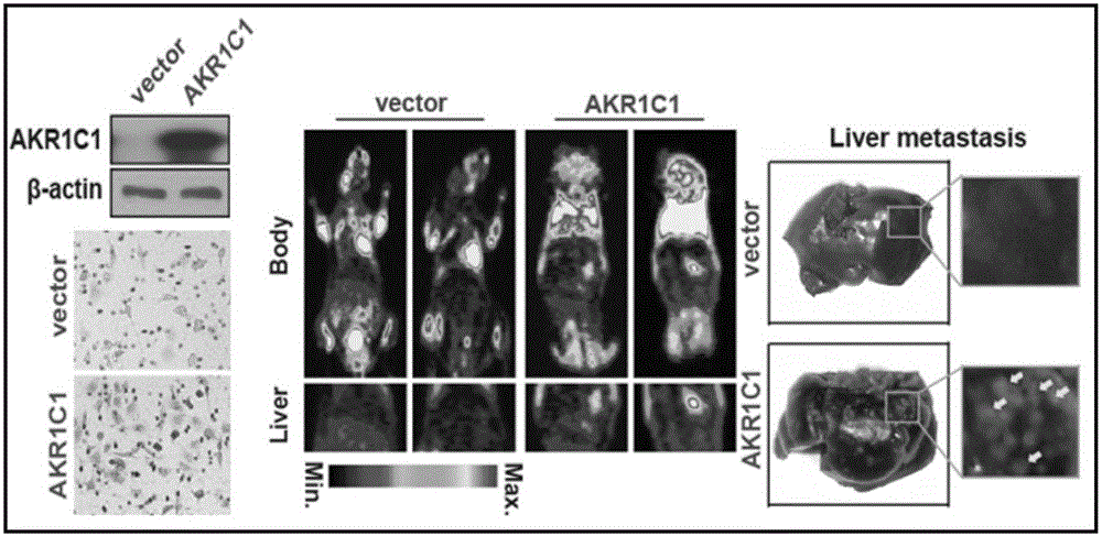 Application of AKR1C1 protein