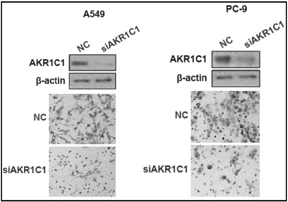 Application of AKR1C1 protein