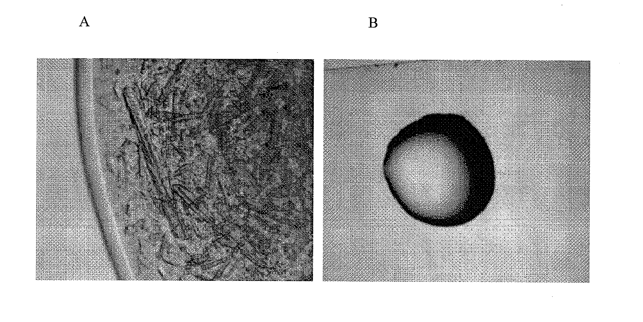 High pressure protein crystallization