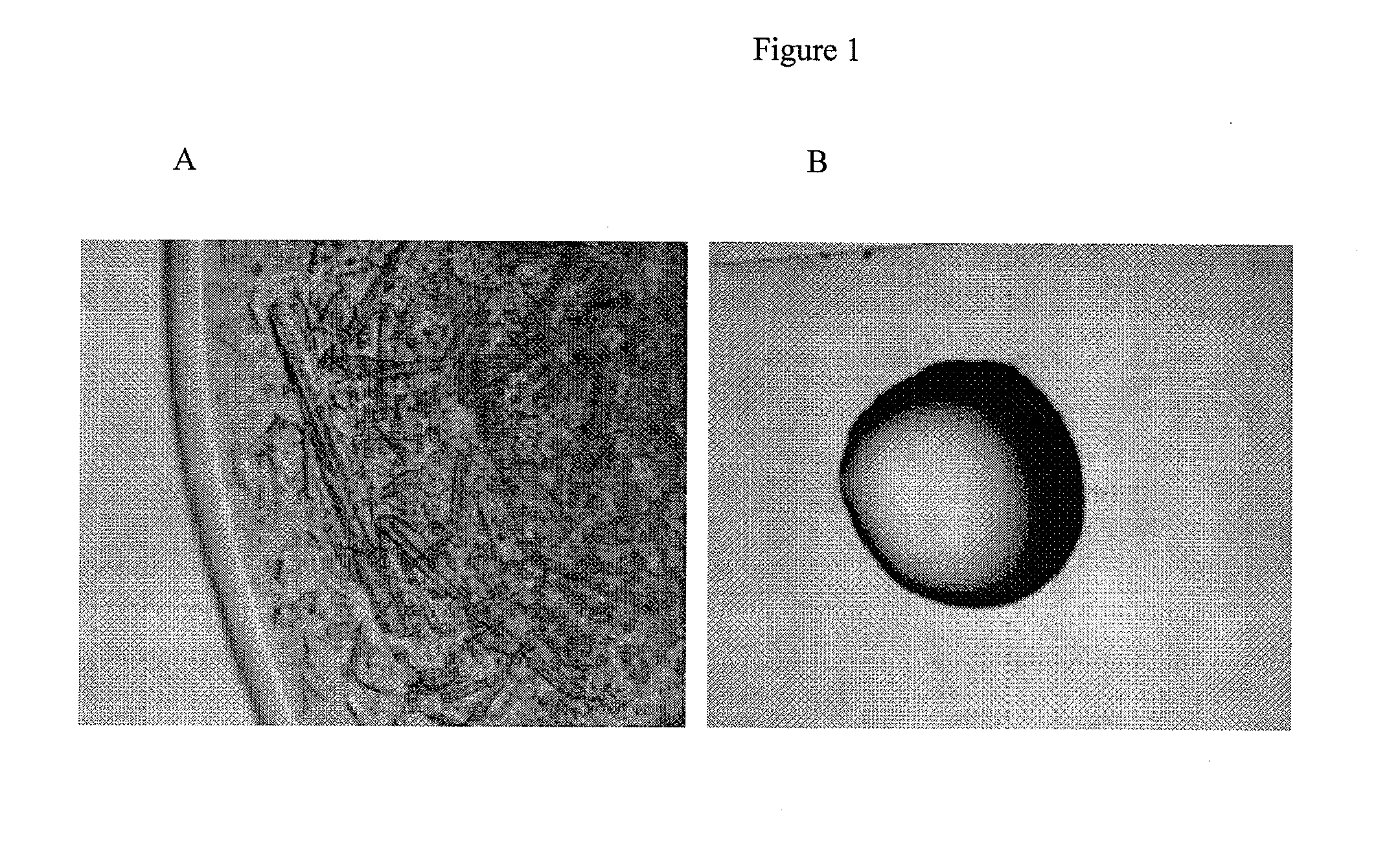 High pressure protein crystallization