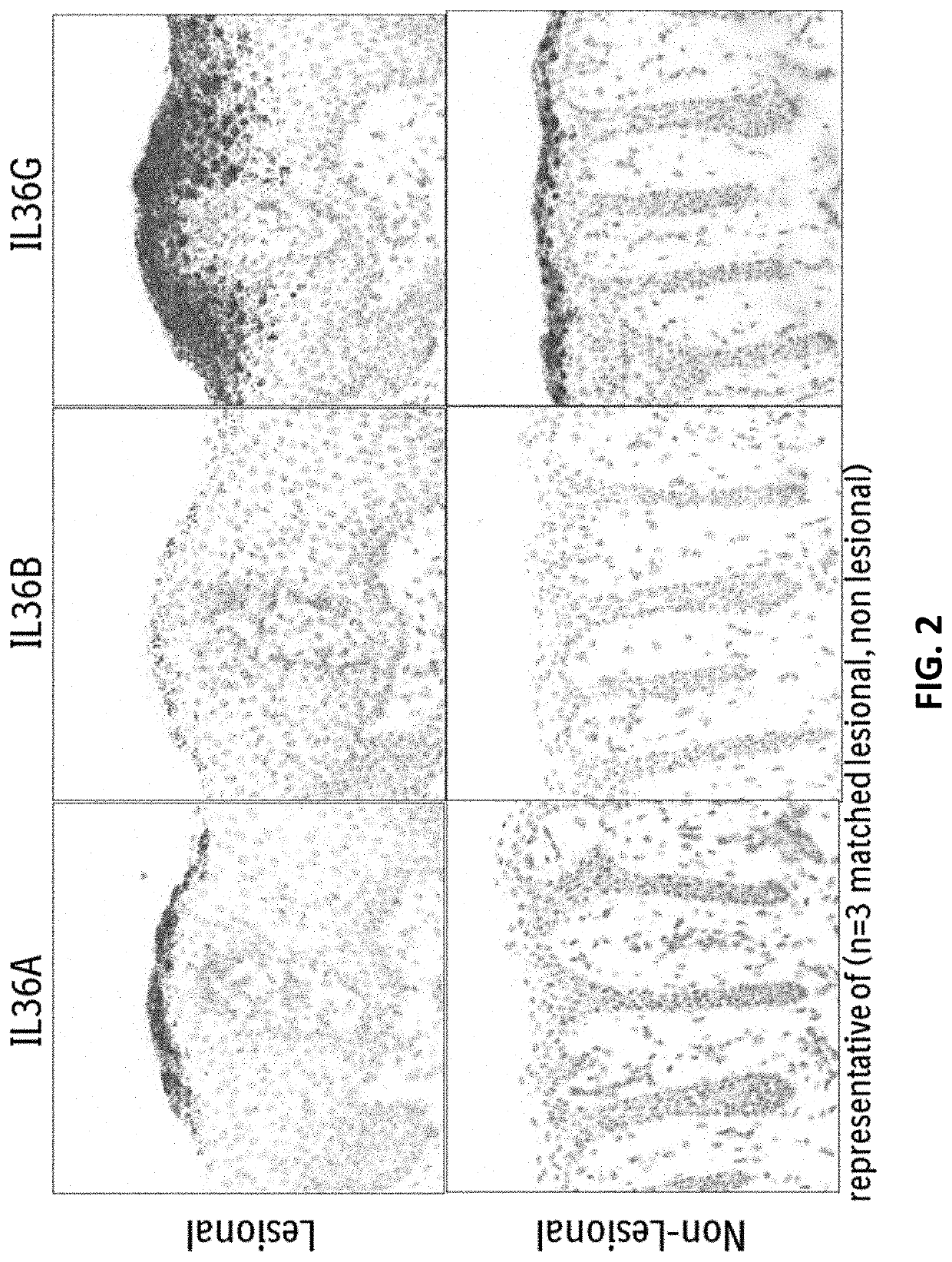 Anti-il-36r antibodies for the treatment of neutrophilic dermatoses