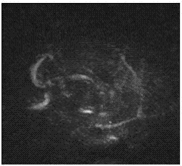 Photoacoustic microscope and method for monitoring breaking of microvesicles in biological tissue