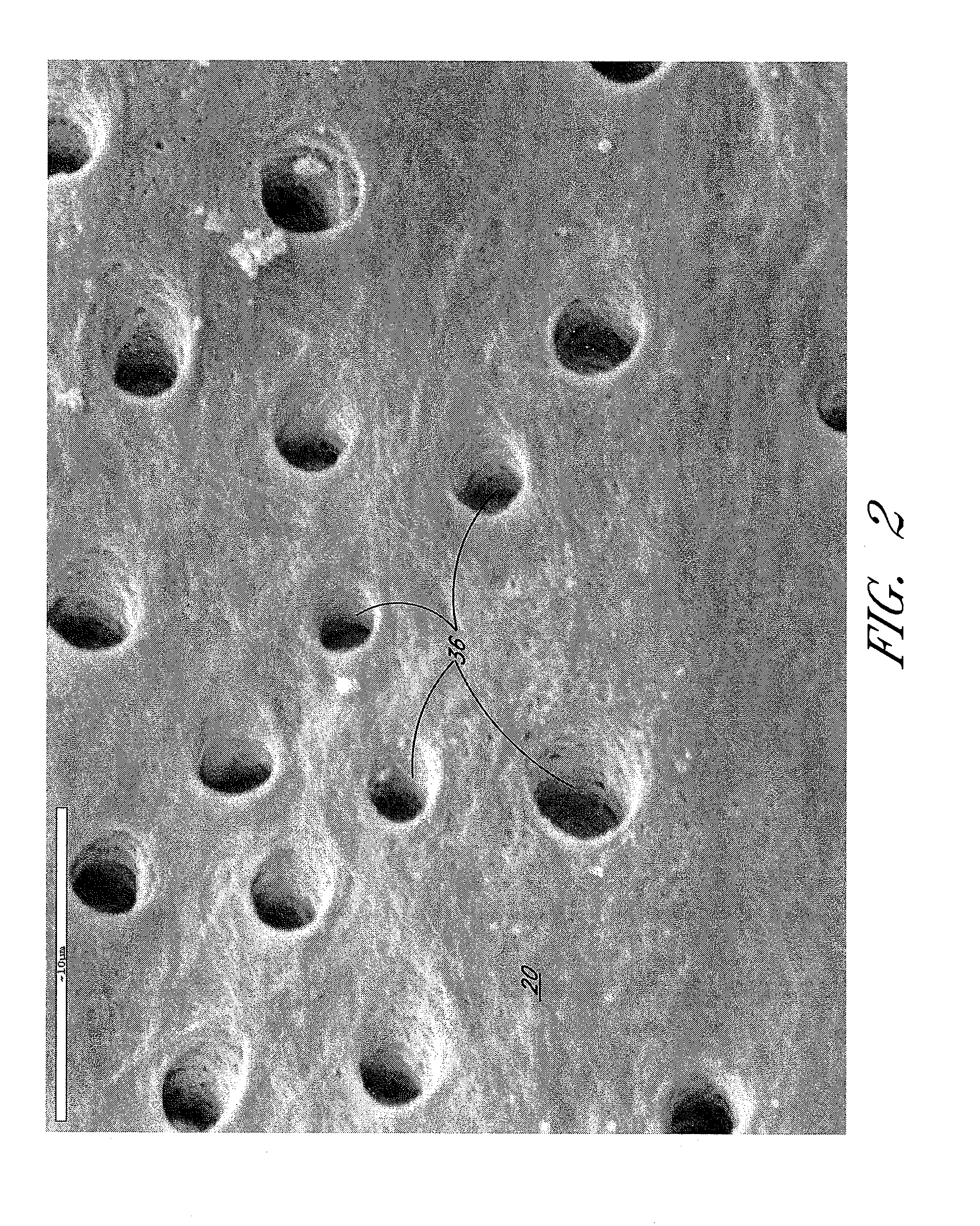 Apparatus and methods for root canal treatments