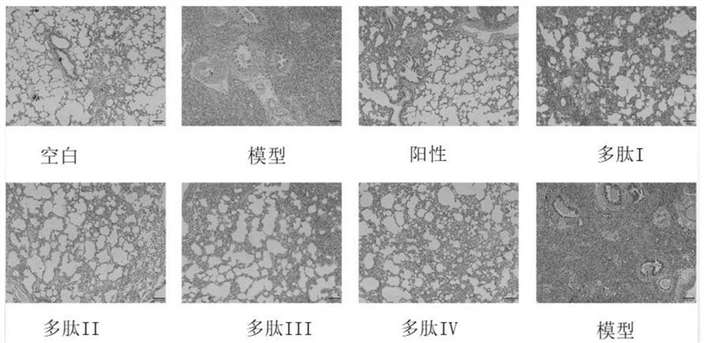 A kind of polypeptide and its application