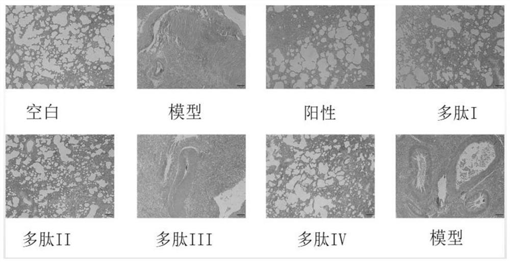 A kind of polypeptide and its application