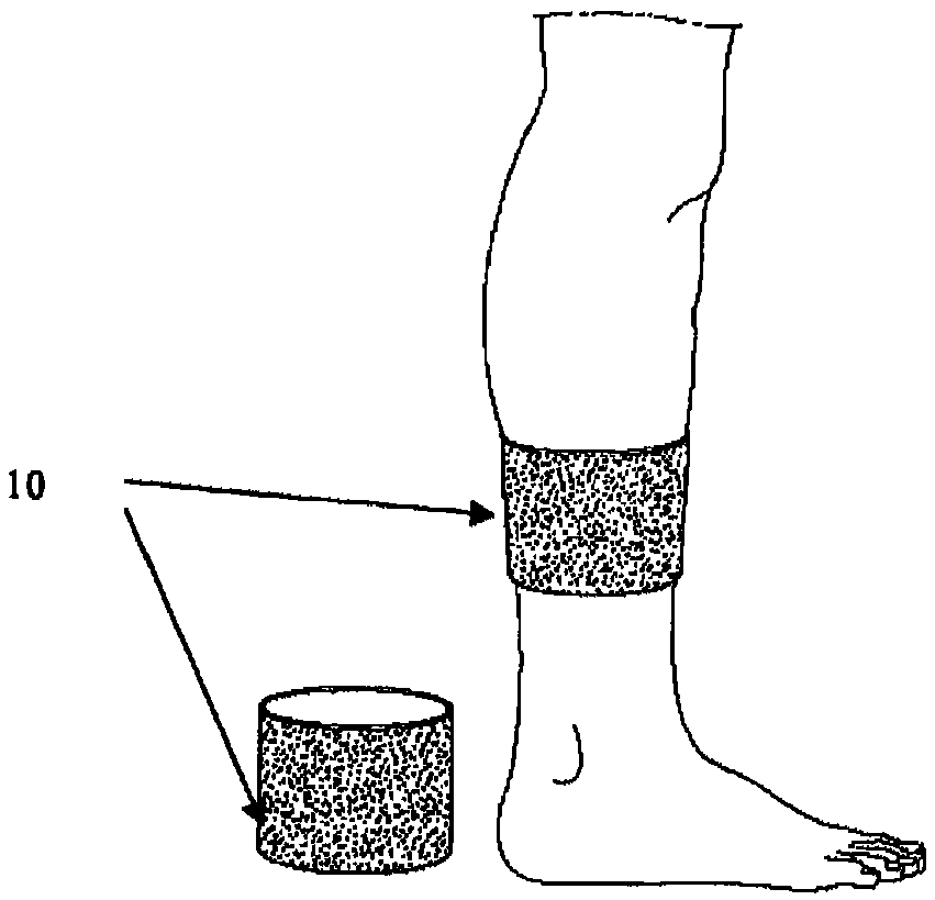 Device, method, and use for treatment of neuropathy involving nitric oxide