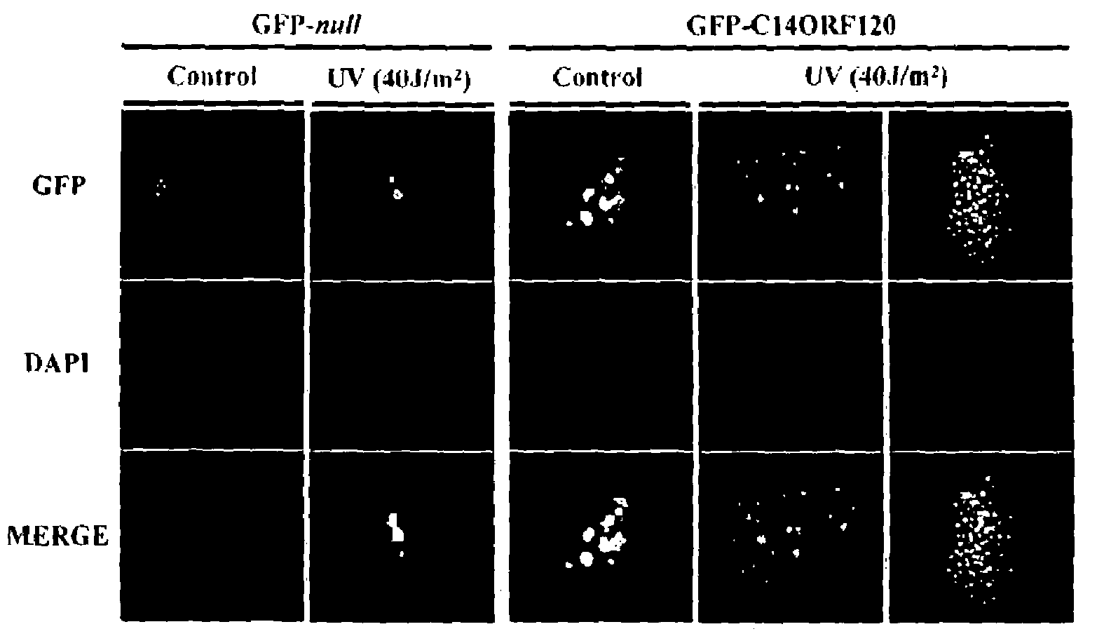 Protein associated with colorectal cancer, polynucleotide including single-nucleotide polymorphism associated with colorectal cancer, microarray and diagnostic kit including the same, and method of diagnosing colorectal cancer using the same