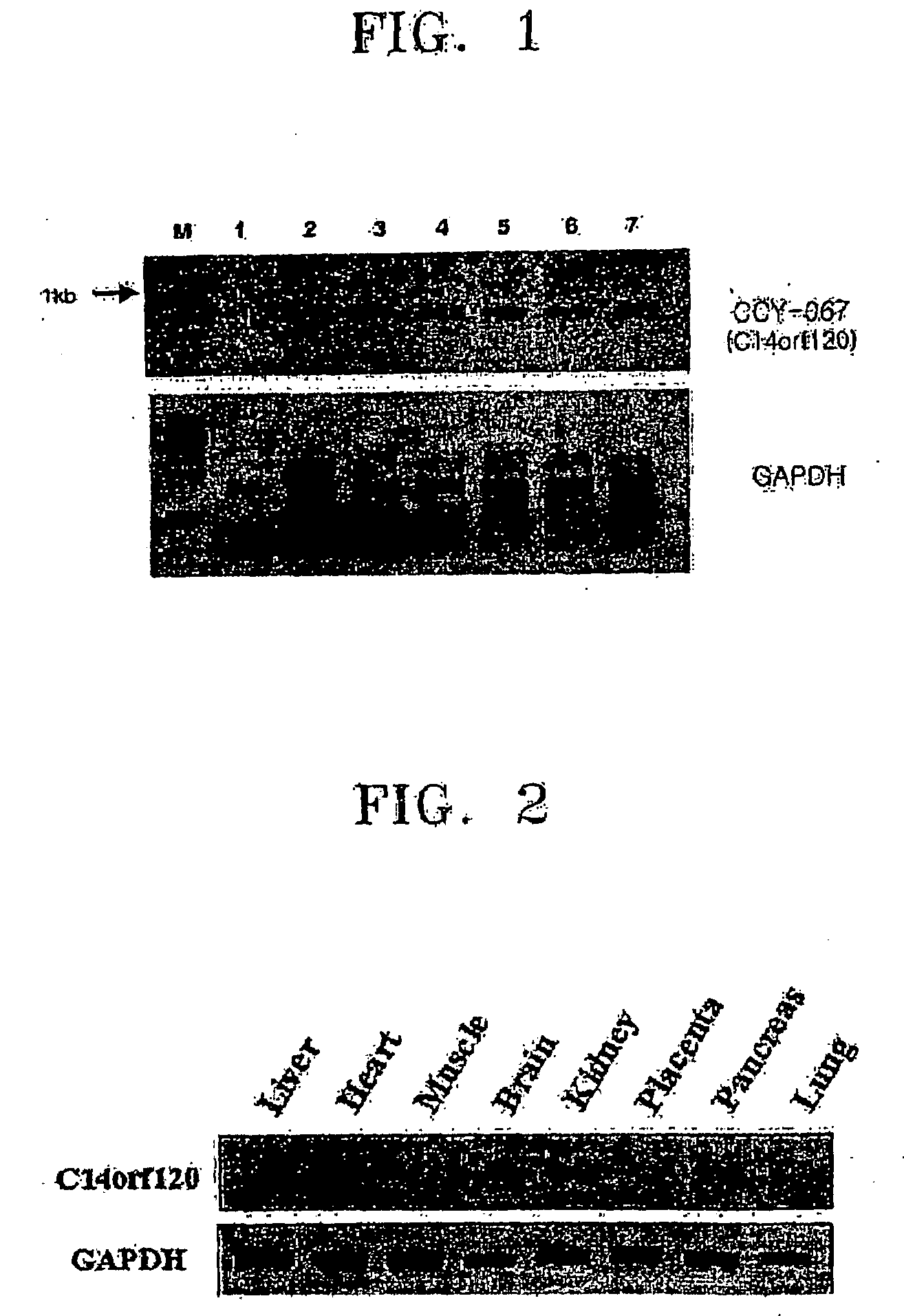 Protein associated with colorectal cancer, polynucleotide including single-nucleotide polymorphism associated with colorectal cancer, microarray and diagnostic kit including the same, and method of diagnosing colorectal cancer using the same