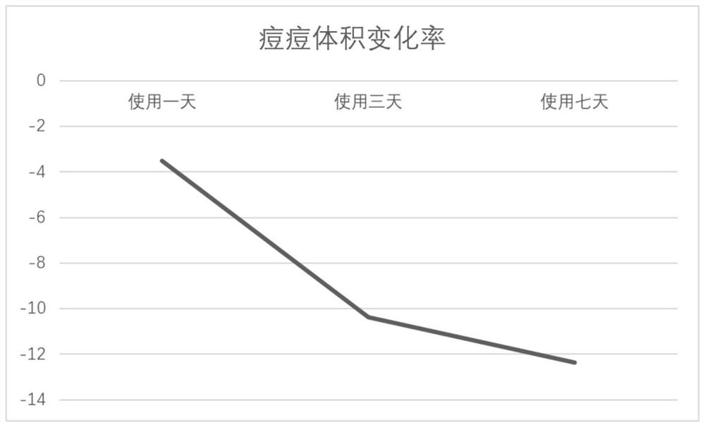 Acne-removing essence lotion and preparation method thereof