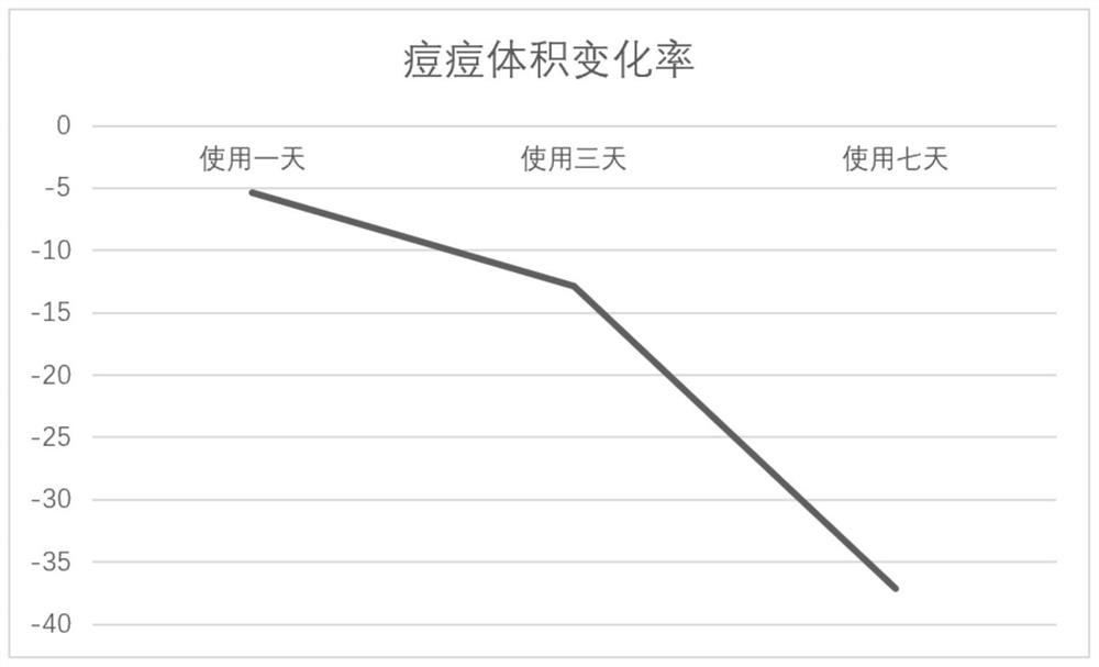 Acne-removing essence lotion and preparation method thereof