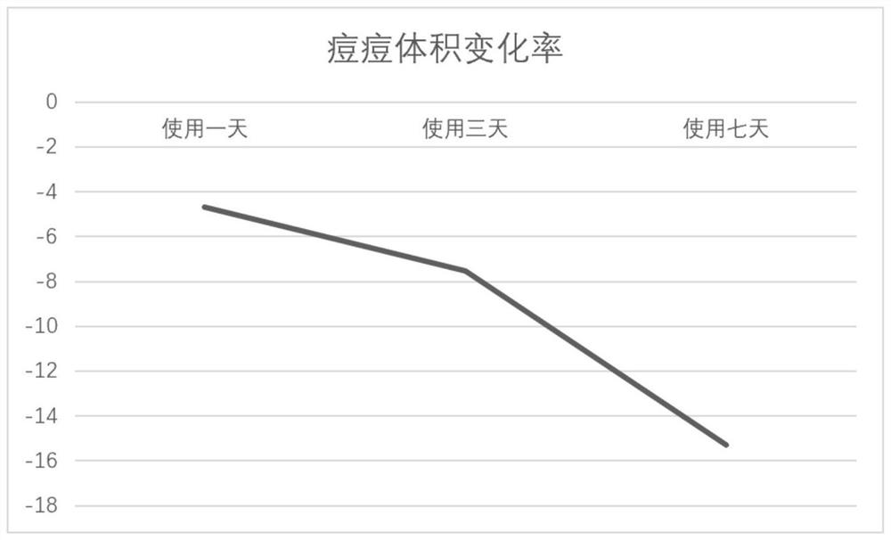 Acne-removing essence lotion and preparation method thereof