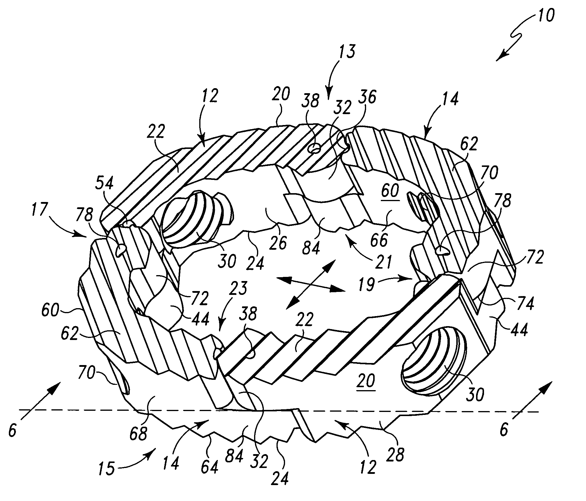 Radially expandable spinal interbody device and implantation tool