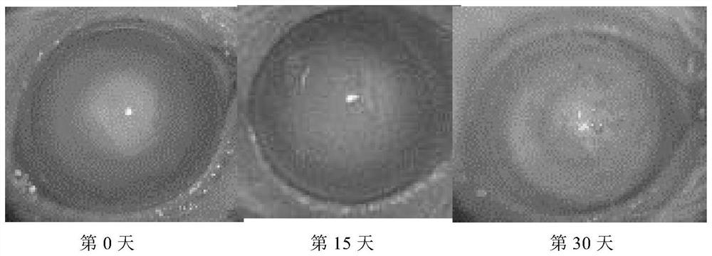 Traditional Chinese medicine general flavone extract for treating cataract and composition, preparation method and medical application thereof