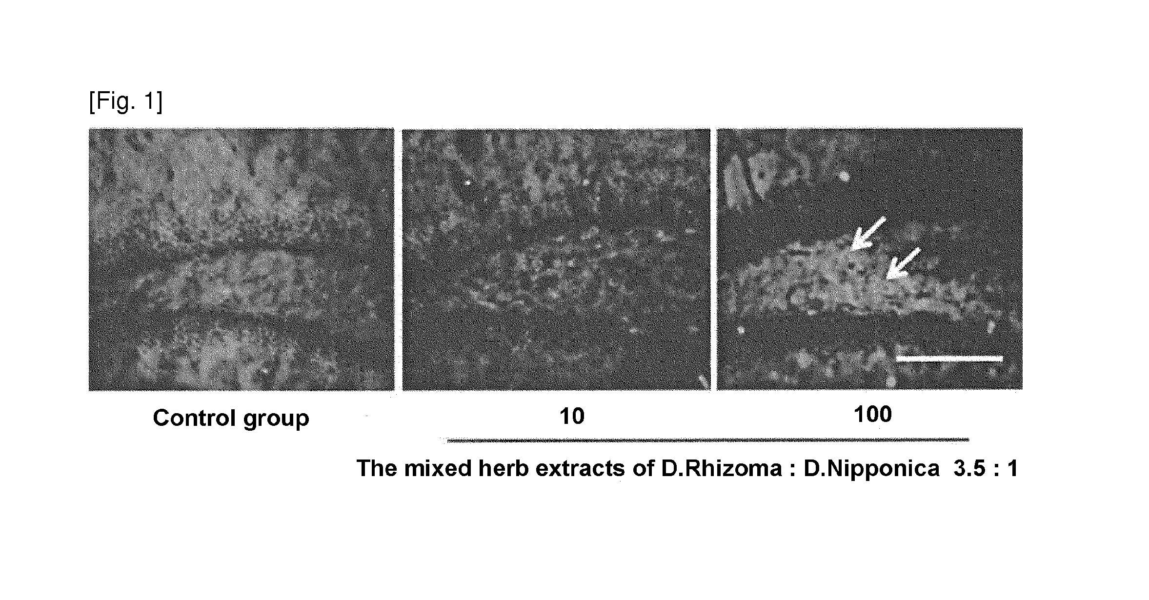 Composition comprising the extract of herbs for preventing or treating neurodegenerative disorders