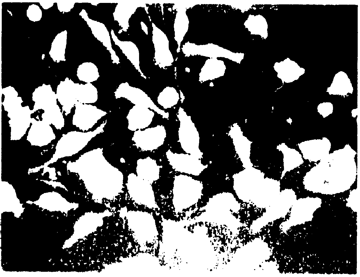 Urokinase plasminogen activator receptor as a target for diagnosis of metastases